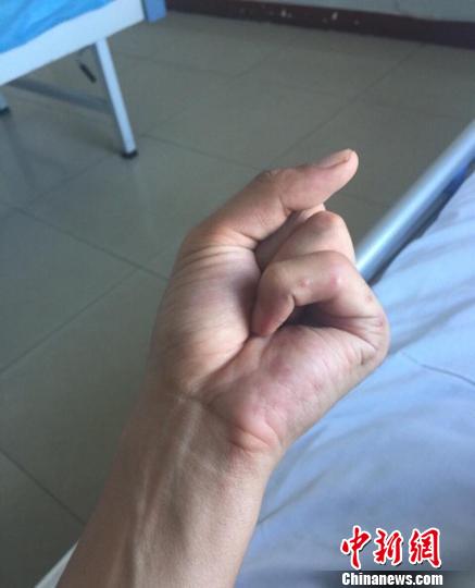 �������ص�����СĴָ�Ѿ���������������ֱ������� ��